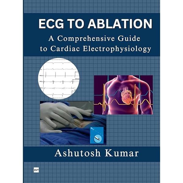 Electrocardiography of Arrhythmias: A Comprehensive Review: A